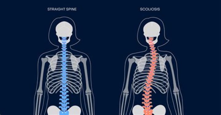 Ellen Pompeo's Journey with Scoliosis: A Story of Resilience