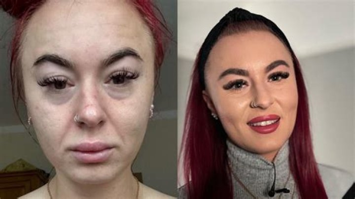 Lyn May: A Journey of Transformation - Before and After