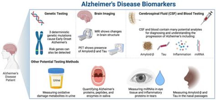 The Revolutionary Role of Alzheimer Biomarkers in Early Detection and Treatment
