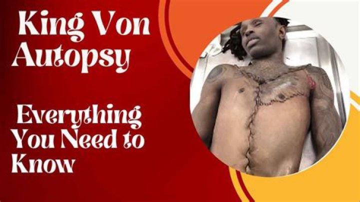 Unveiling the Truth: King Von's Autopsy